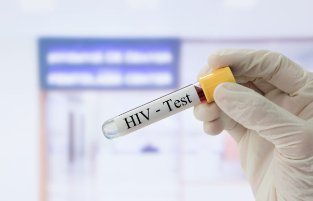 Can Cellphones Detect HIV?